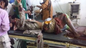 إصابة 11 بينهم 6 جنود بانفجار عبوة ناسفة استهدفت طقما للحزام الأمني بأبين