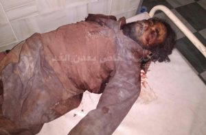 مقتل جبريل الحالمي برصاص الأمن بردفان على خلفية انتقادة الامارات