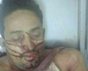 هكذا قتل مدير أمن مديرية في أبين برصاص أمن شلال في عدن ؟