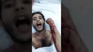 جريح جنوبي يتعرض للضرب في احدى مستشفات شرورة السعودي
