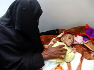 «أوكسفام»: اليمن تقترب نحو المجاعة أكثر من أي وقت مضى 