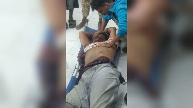 أنباء عن إصابة أبو مشعل الكازمي في مواجهات لودر