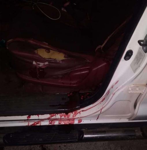 إصابة قائد عسكري في الانتقالي بإصابات خطيرة بهجوم مسلح في عدن
