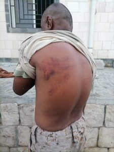 الحراك الثوري يدين اعتقال وتعذيب جنود النخبة الحضرمية من قبل الضباط الإماراتيين