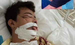 قيادات الانتقالي ترتكب جريمة دهس جديدة تطال طفل في عدن