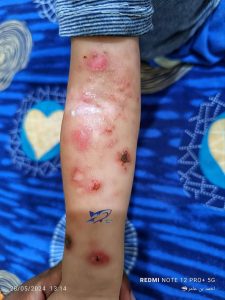 صورة تلخص وضع أطفال عدن جراء انقطاع الكهرباء .. هل يعيش أطفال قيادات الانتقالي مثلهم?